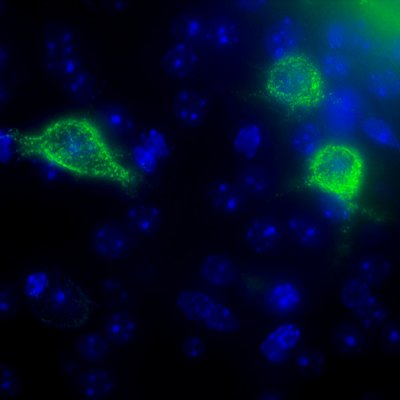 Perineuronal nets (bright green) surround particular neurons (blue). Fluorescence labelling reveals just how detailed these structures are.  (Phoebe Mayne, UQ) 